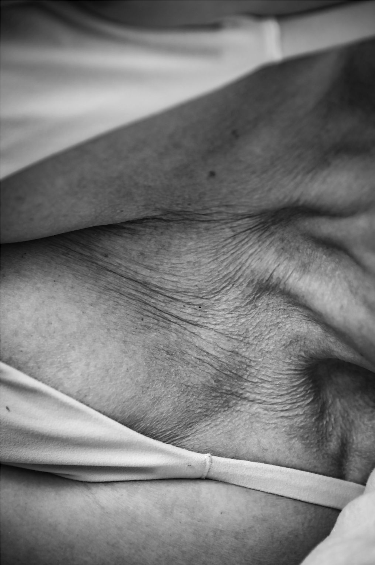 How Back Sleeping Helps Minimize Chest Lines